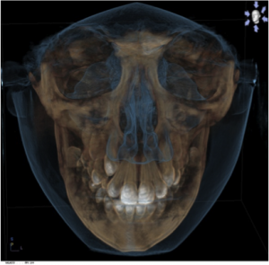 xray2