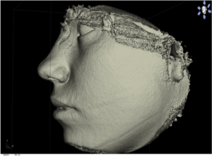 xray3
