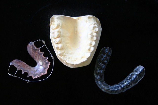 Retainers: What You Need to Know