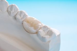Chipped A Crown? Here's What To Do